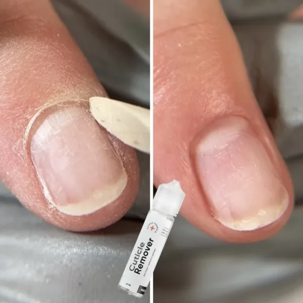 Nailsoftheday - Cuticle Remover – регенеруючий кутикул ремувер для манікюру та педикюру, urea 10%, 60 мл - Image 5